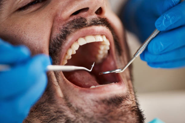 Best Knocked-Out Tooth Emergency  in Shelburne Falls, MA